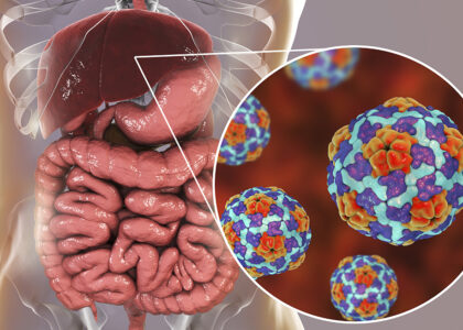 Illustration depicting Hepatitis A virus and its impact on the liver, emphasizing the importance of Hepatitis A vaccination for protecting against the infection.